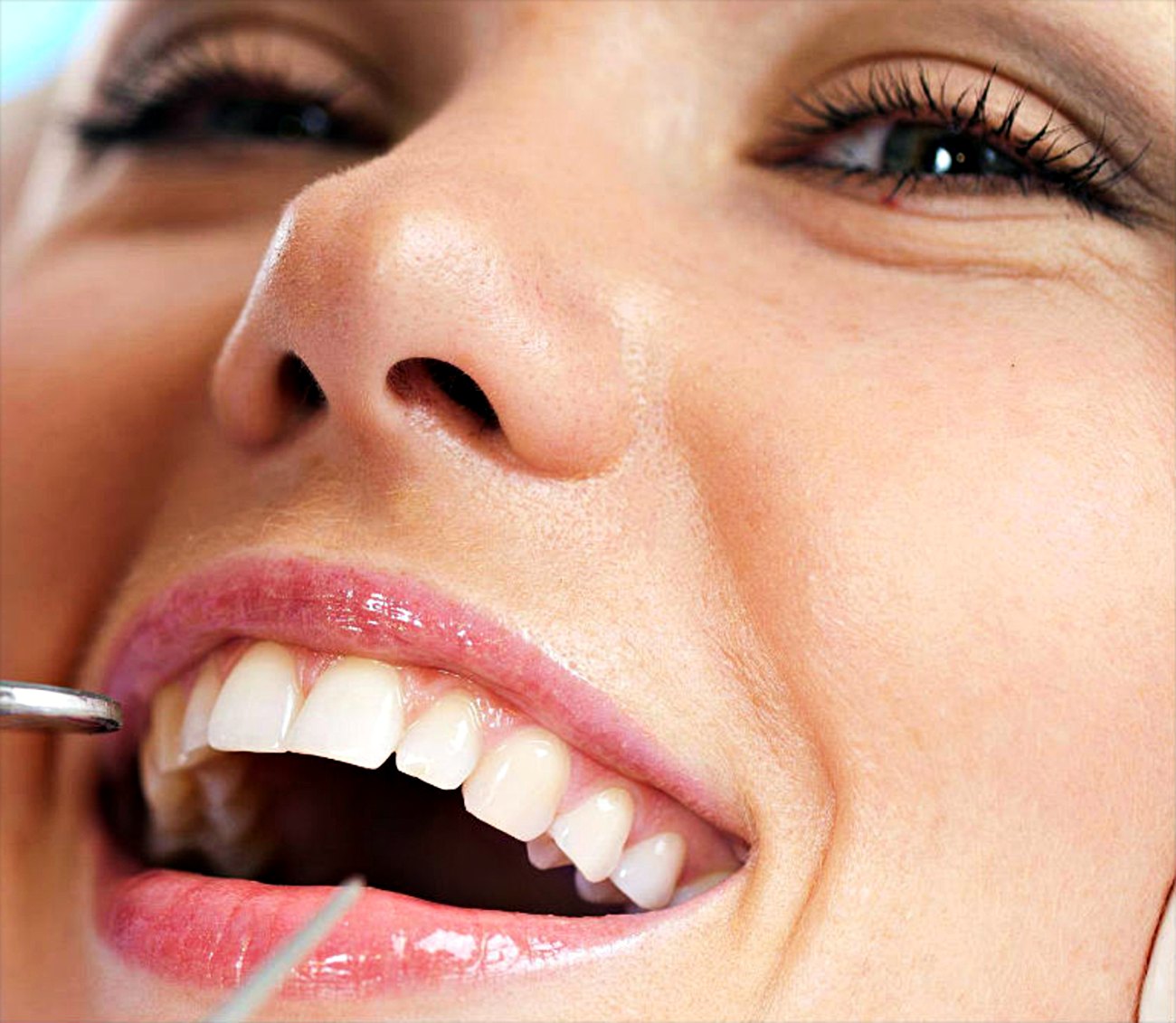 A patient smiling during a check-up at Mission Bay Dental