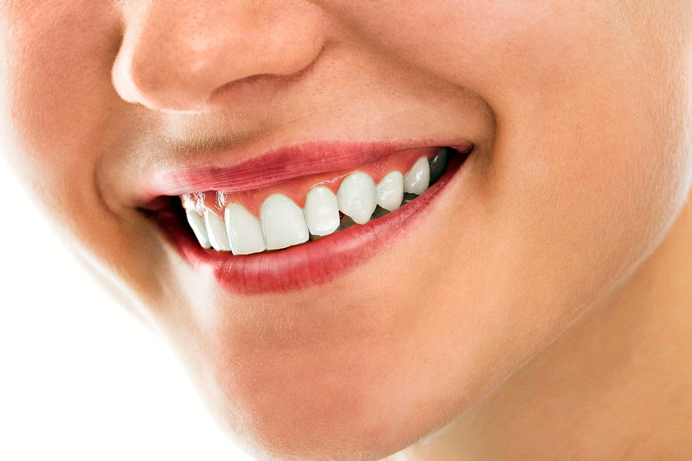 A bright, natural smile